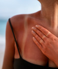 Ako sa nespáliť na slnku: Reálne tipy, ktoré fungujú lepšie než SPF 50